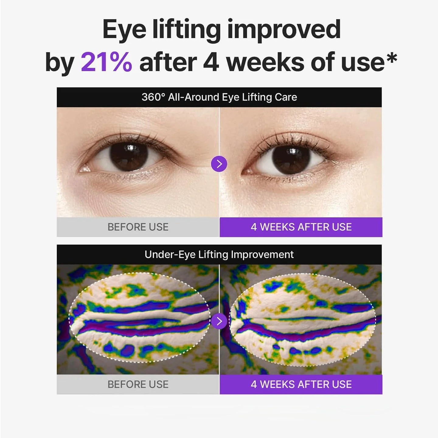 KURAIS 360° PDRN Lifting Eye Cream | Firming & Anti-Wrinkle Under-Eye Treatment (30ml)