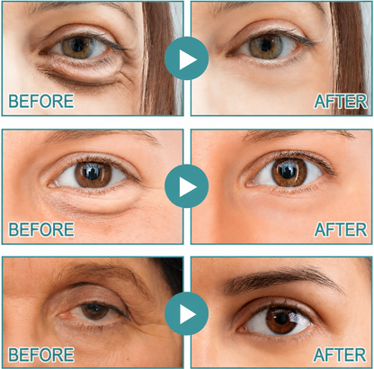 Kurais | Dissolving Microneedle Eye Patches